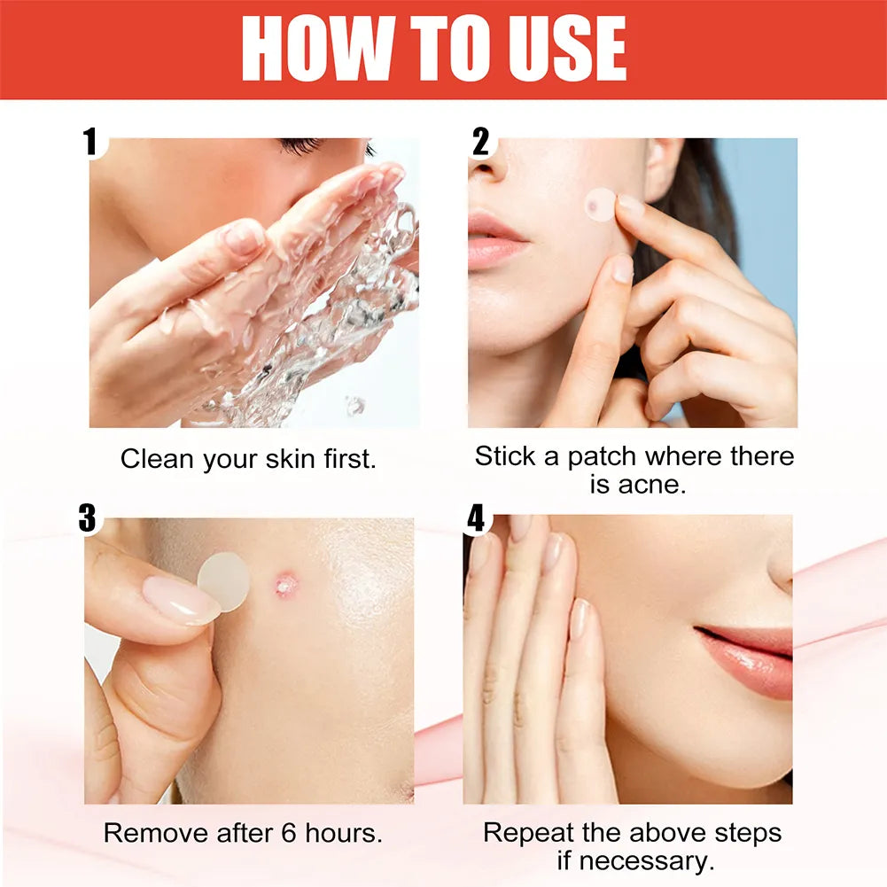 Pimple Patch |Invisible Acne Pimple Patch Stickers