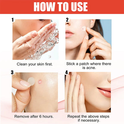 Pimple Patch |Invisible Acne Pimple Patch Stickers