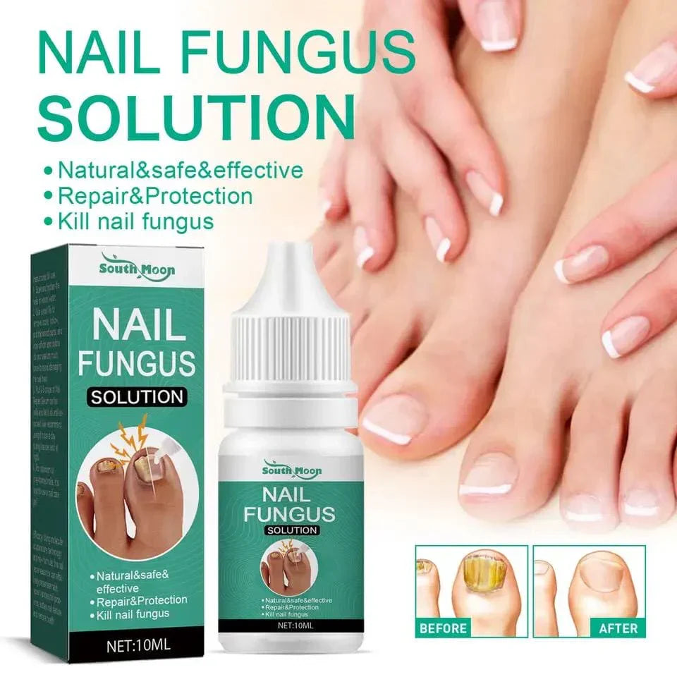 Fast Nail Fungal Repair Essences Serum Care Foot Nail Fungus Removal